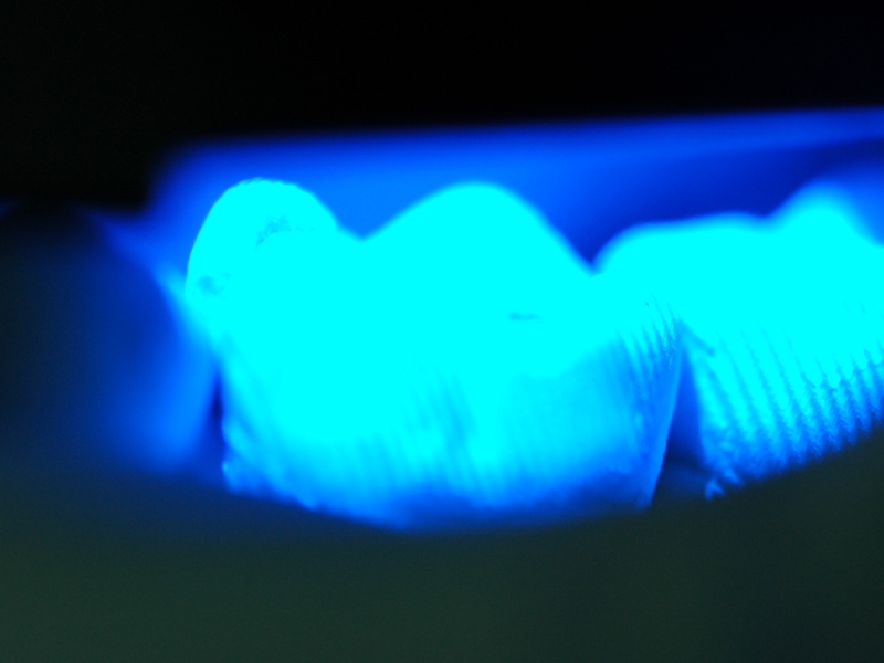 optische Vermessung Zahn